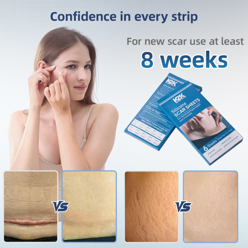 K2K PrimePath ultra-thin reusable silicone scar sheets