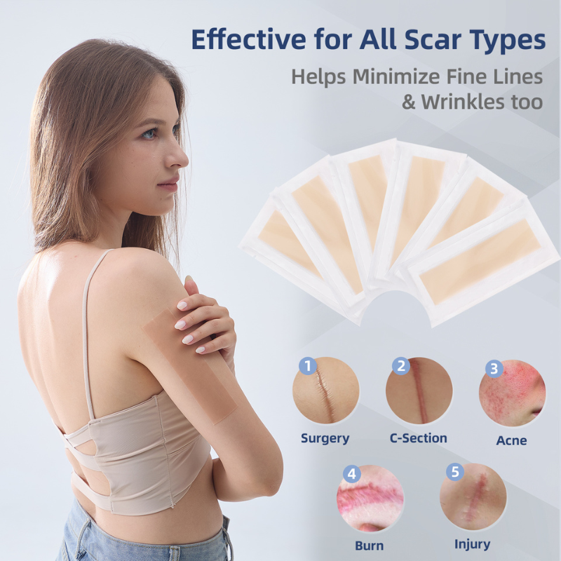 K2K PrimePath ultra-thin reusable silicone scar sheets